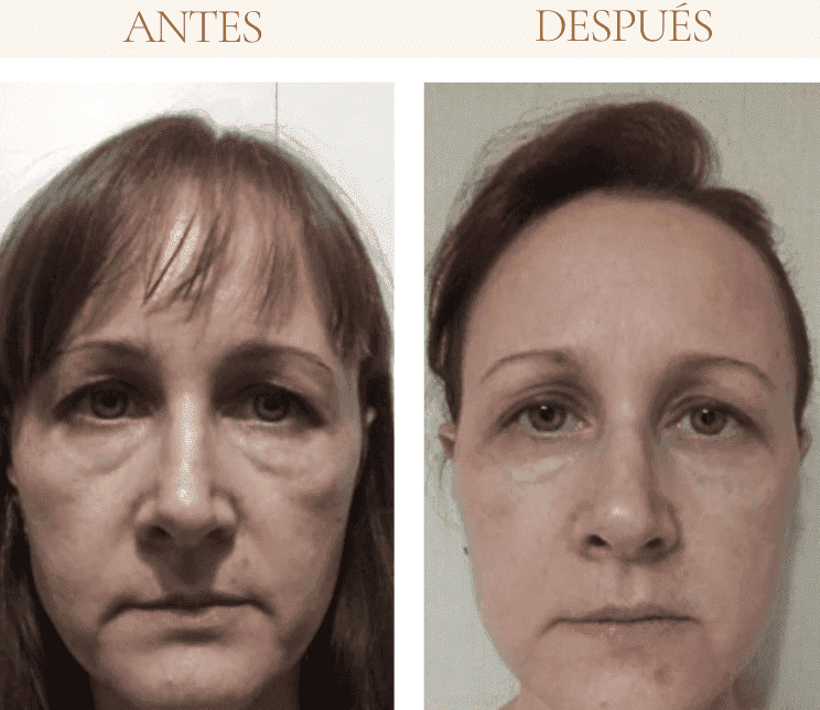 yoga facial metodo eywa