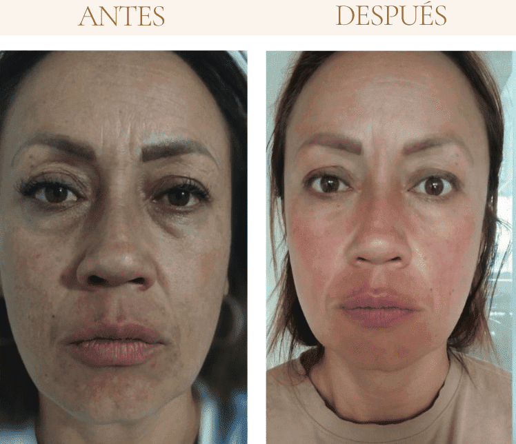 yoga facial metodo eywa