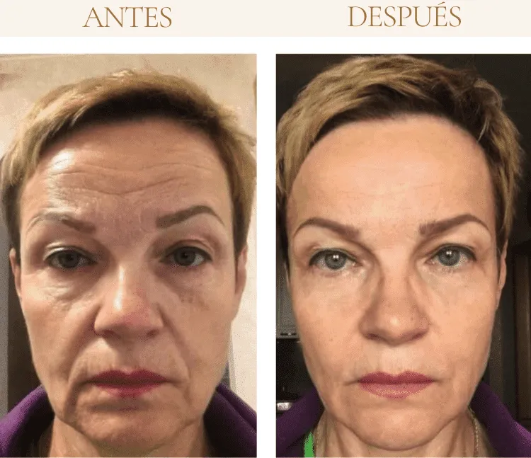 opinion yoga facial metodo eywa